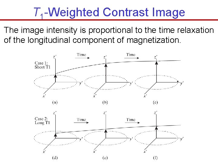 T 1 -Weighted Contrast Image The image intensity is proportional to the time relaxation