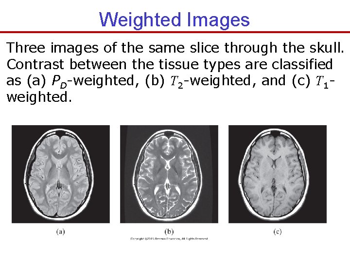 Weighted Images Three images of the same slice through the skull. Contrast between the