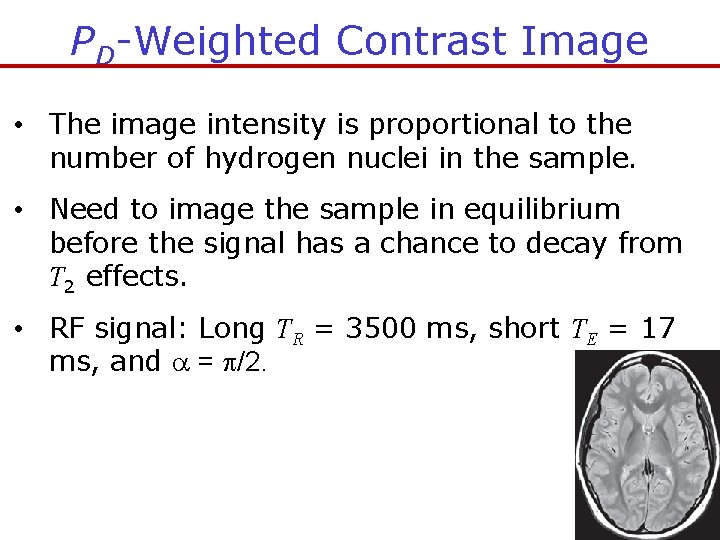 PD-Weighted Contrast Image • The image intensity is proportional to the number of hydrogen