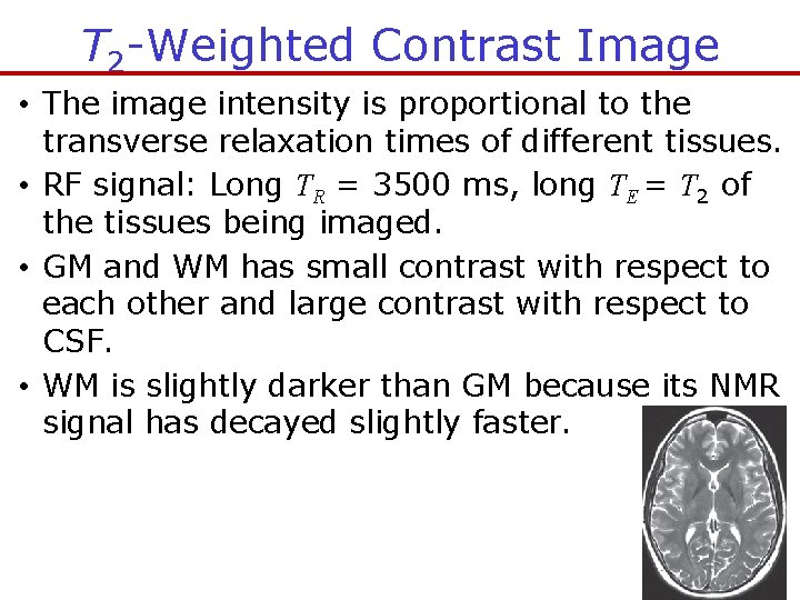 T 2 -Weighted Contrast Image • The image intensity is proportional to the transverse