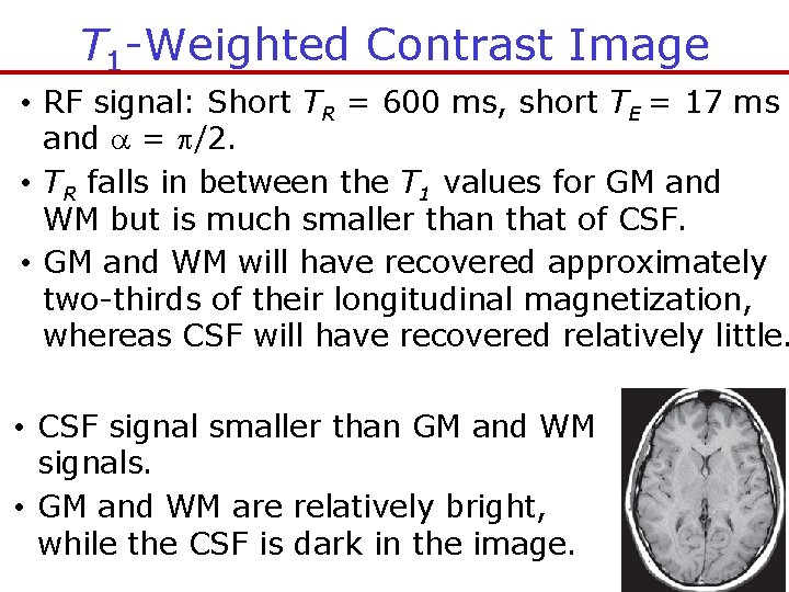 T 1 -Weighted Contrast Image • RF signal: Short TR = 600 ms, short