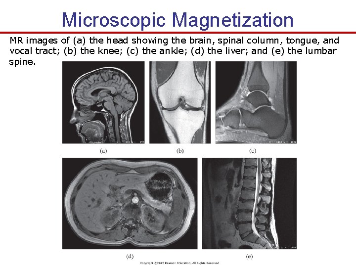 Microscopic Magnetization MR images of (a) the head showing the brain, spinal column, tongue,