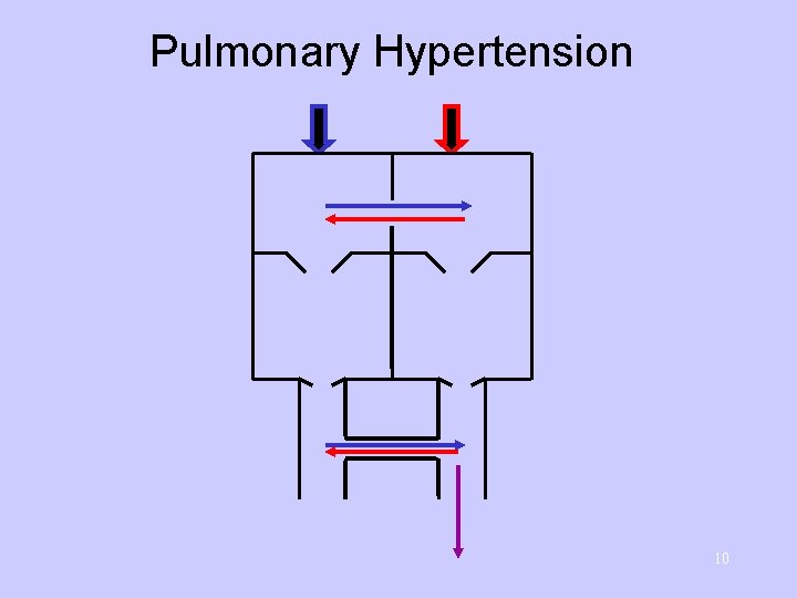 Pulmonary Hypertension 10 
