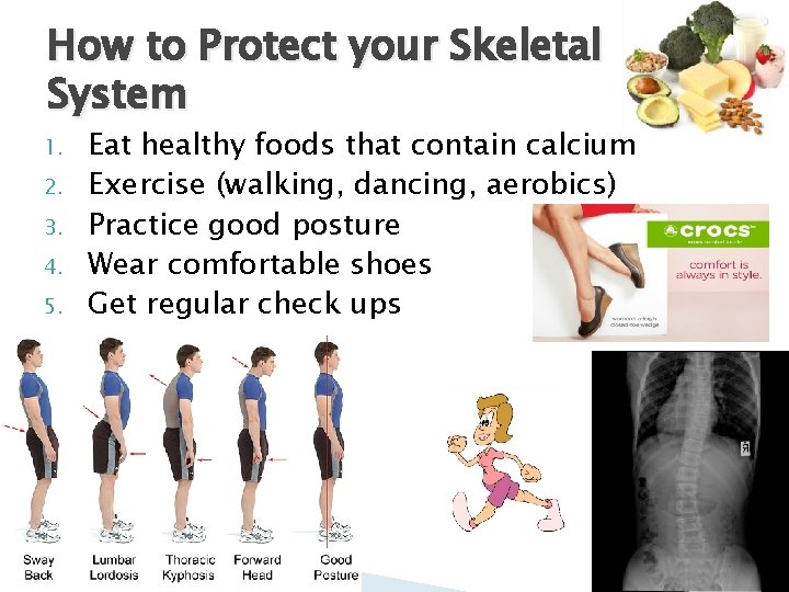 How to Protect your Skeletal System 1. 2. 3. 4. 5. Eat healthy foods