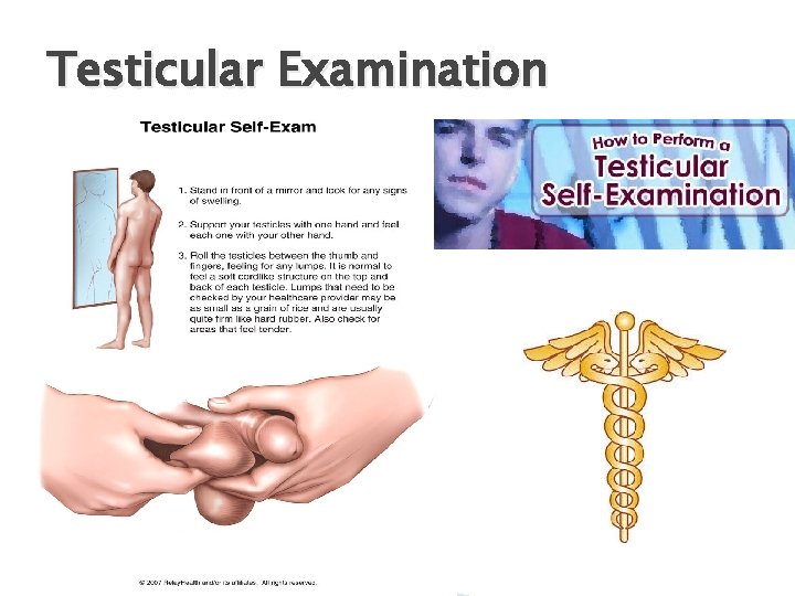 Testicular Examination 