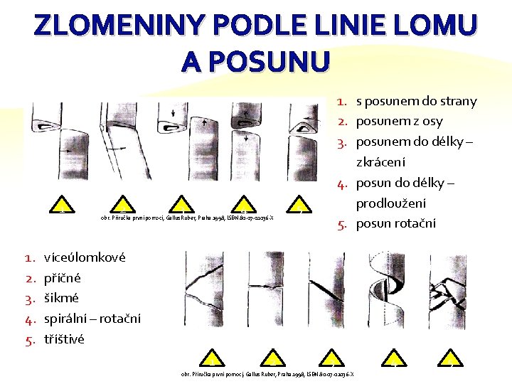 ZLOMENINY PODLE LINIE LOMU A POSUNU 1 1. 2. 3. 4. 5. 2 3