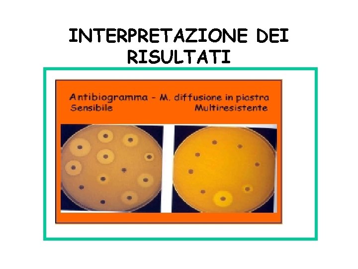 INTERPRETAZIONE DEI RISULTATI 