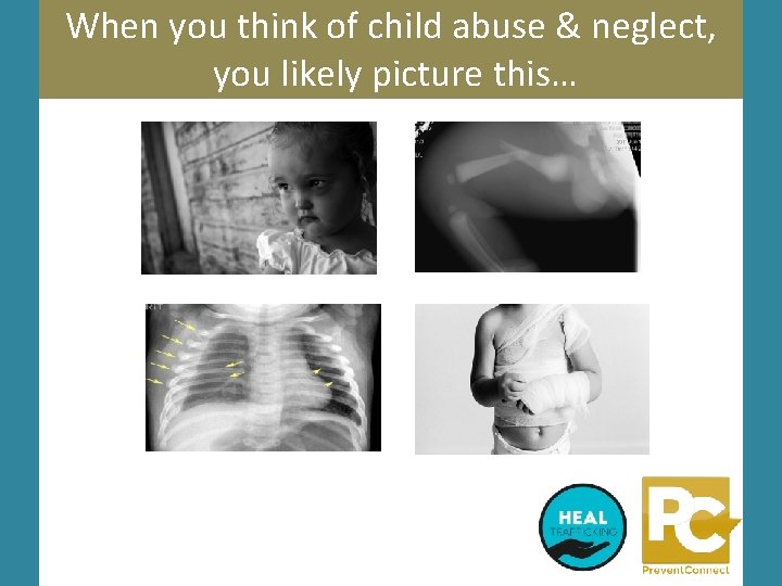 When you think of child abuse & neglect, you likely picture this… 