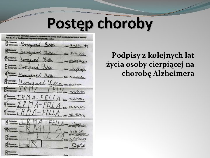 Postęp choroby Podpisy z kolejnych lat życia osoby cierpiącej na chorobę Alzheimera 