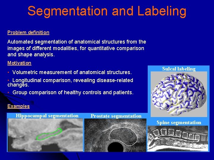 Segmentation and Labeling Problem definition Automated segmentation of anatomical structures from the images of