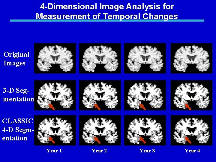 4 -Dimensional Image Analysis for Measurement of Temporal Changes Original Images 3 -D Segmentation