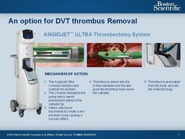 An option for DVT thrombus Removal ANGIOJET™ ULTRA Thrombectomy System MECHANISM OF ACTION 1.