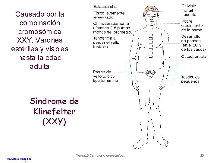 Causado por la combinación cromosómica XXY. Varones estériles y viables hasta la edad adulta