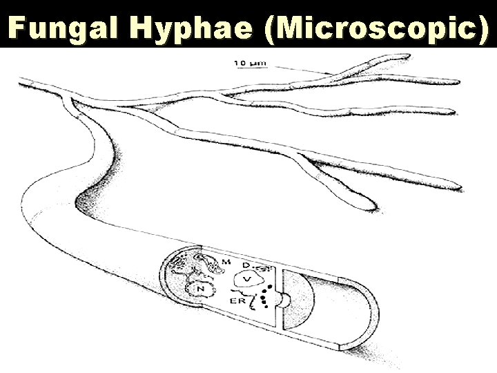 Fungal Hyphae (Microscopic) 