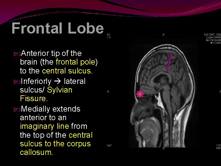 Frontal Lobe Anterior tip of the brain (the frontal pole) to the central sulcus.