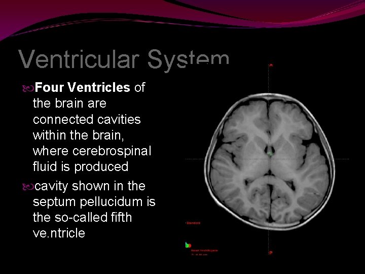 Ventricular System Four Ventricles of the brain are connected cavities within the brain, where