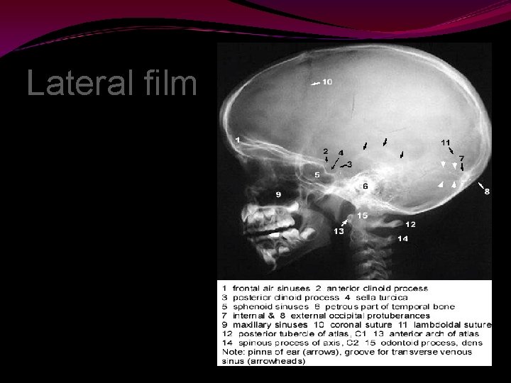 Lateral film 