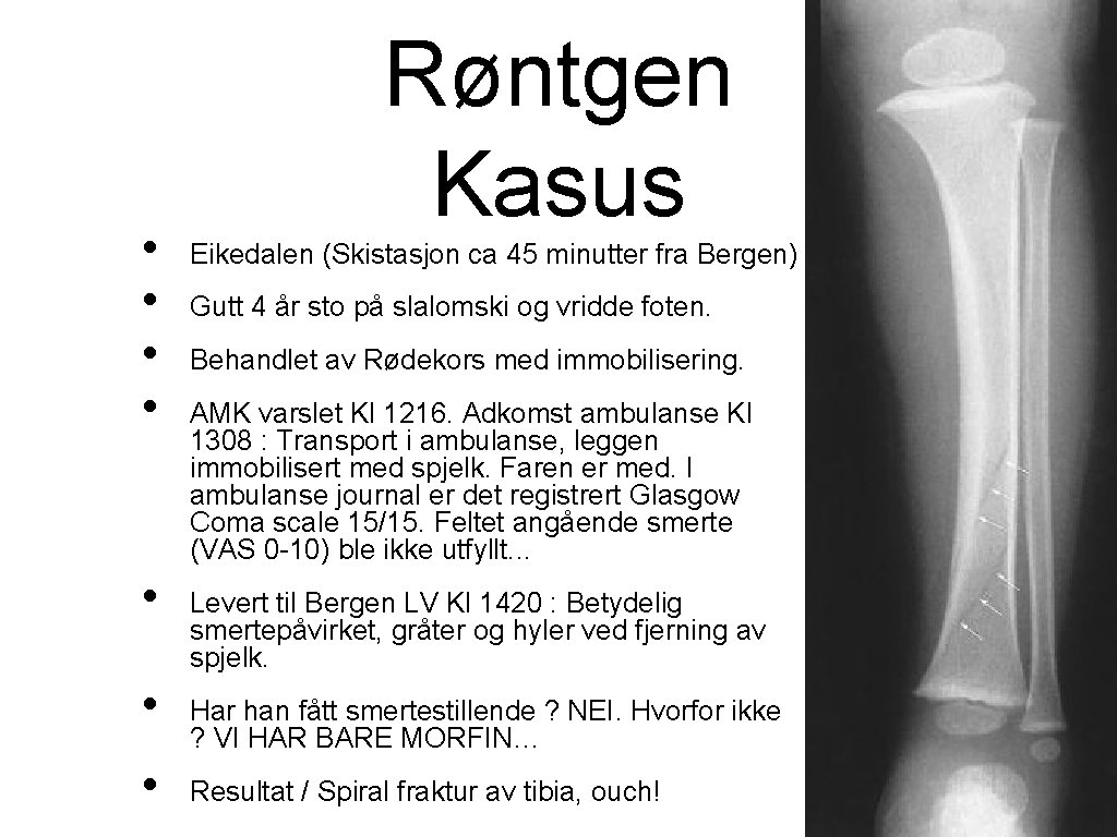  • • Røntgen Kasus Eikedalen (Skistasjon ca 45 minutter fra Bergen) Gutt 4