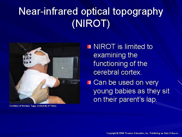 Near-infrared optical topography (NIROT) NIROT is limited to examining the functioning of the cerebral