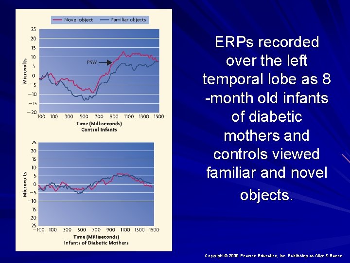 ERPs recorded over the left temporal lobe as 8 -month old infants of diabetic