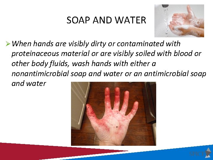 SOAP AND WATER Ø When hands are visibly dirty or contaminated with proteinaceous material