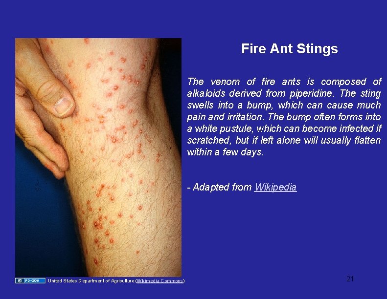 Fire Ant Stings The venom of fire ants is composed of alkaloids derived from