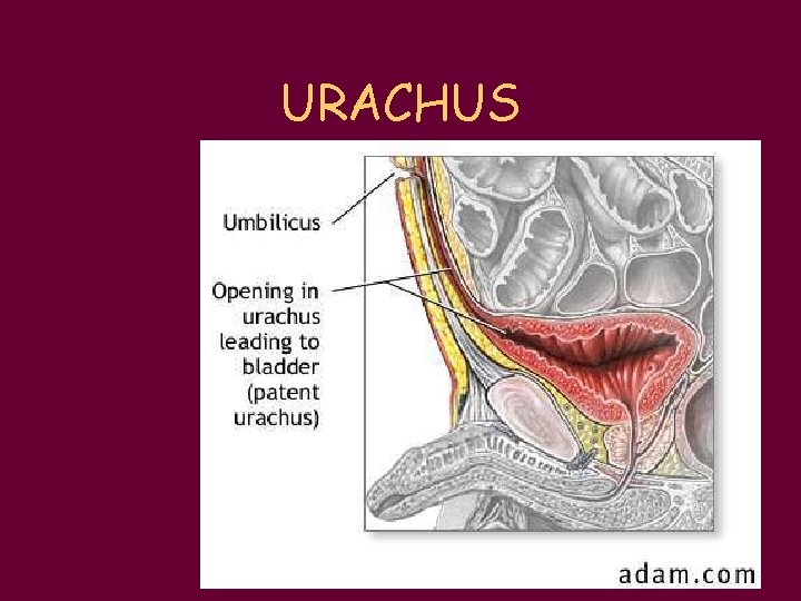 URACHUS 