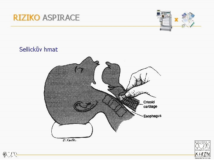 RIZIKO ASPIRACE Sellickův hmat x 