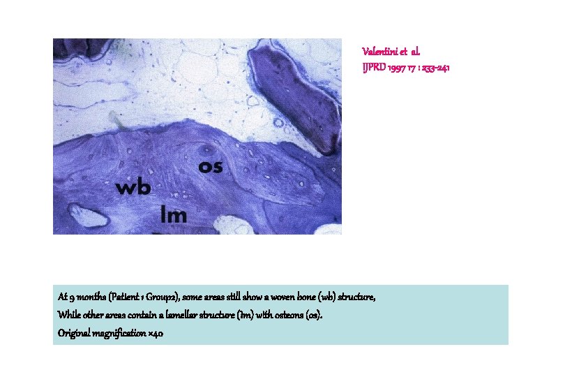 Valentini et al. IJPRD 1997 17 : 233 -241 At 9 months (Patient 1