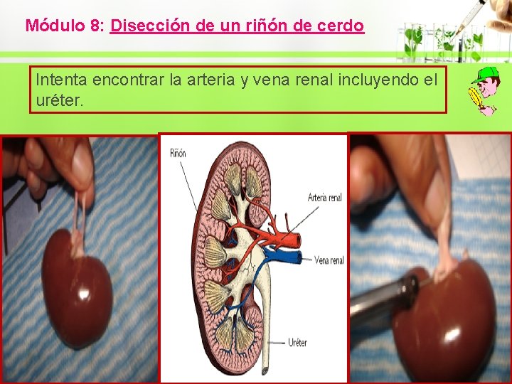 Módulo 8: Disección de un riñón de cerdo Intenta encontrar la arteria y vena