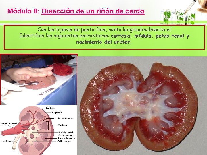 Módulo 8: Disección de un riñón de cerdo Con las tijeras de punta fina,