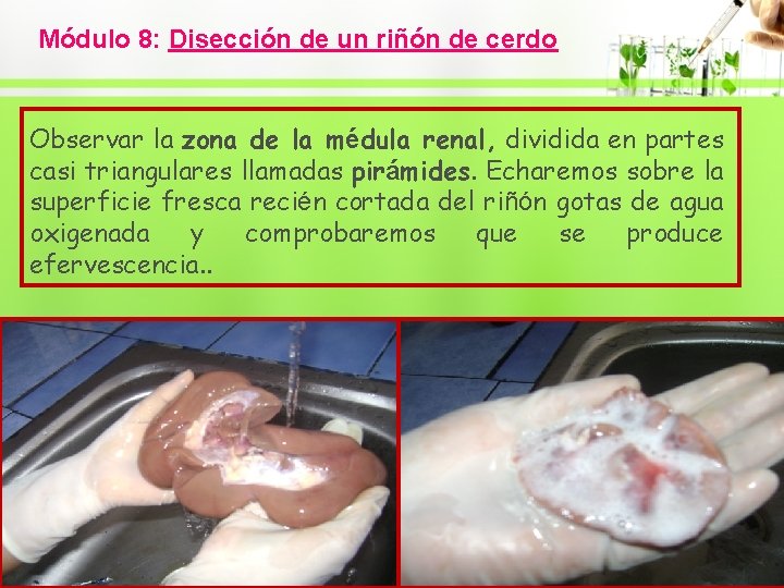 Módulo 8: Disección de un riñón de cerdo Observar la zona de la médula