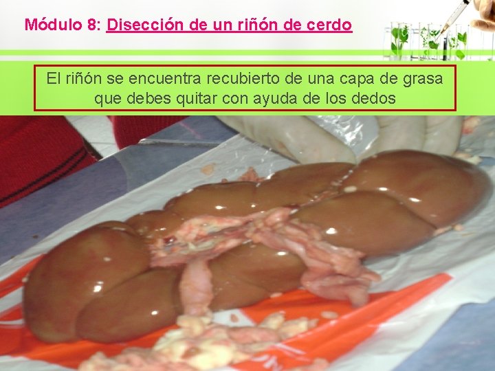 Módulo 8: Disección de un riñón de cerdo El riñón se encuentra recubierto de