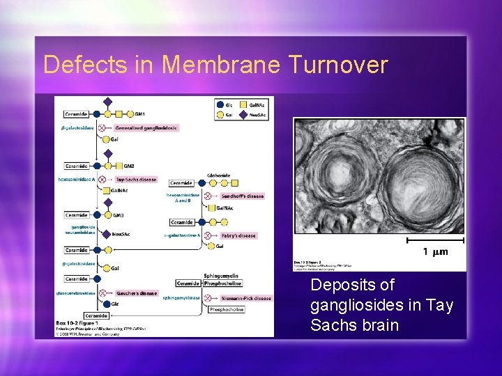 Defects in Membrane Turnover Deposits of gangliosides in Tay Sachs brain 