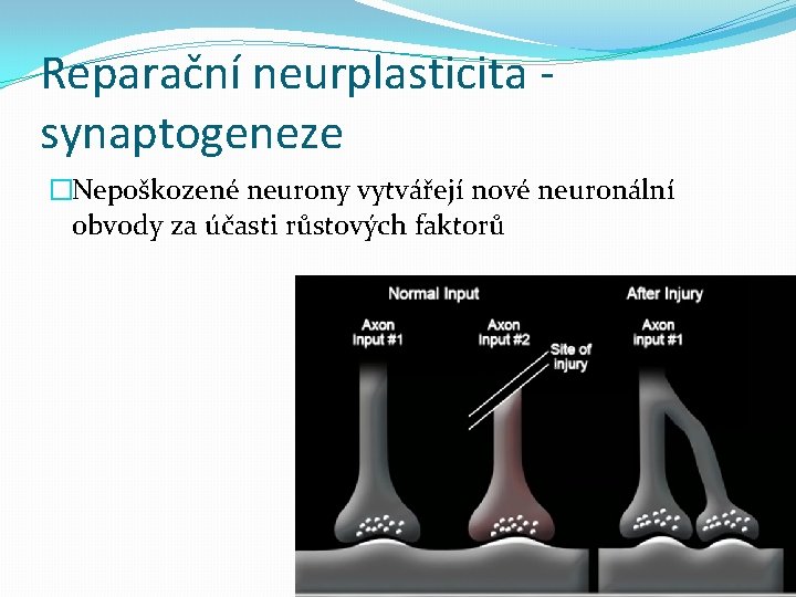 Reparační neurplasticita synaptogeneze �Nepoškozené neurony vytvářejí nové neuronální obvody za účasti růstových faktorů 