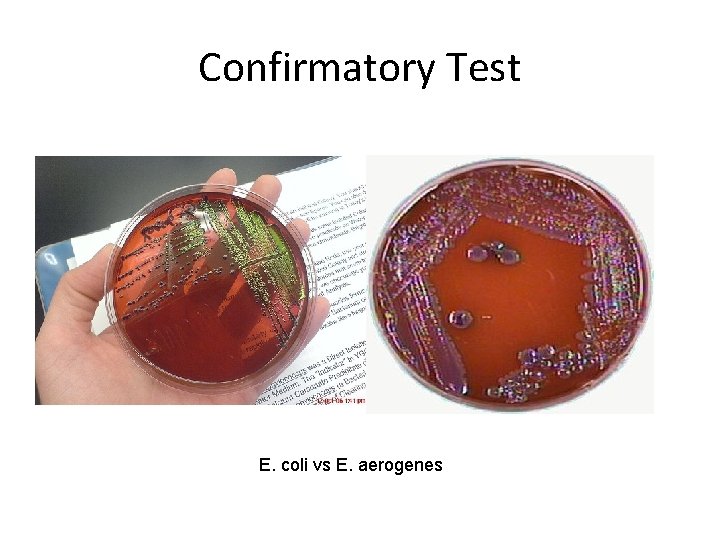 Confirmatory Test E. coli vs E. aerogenes 