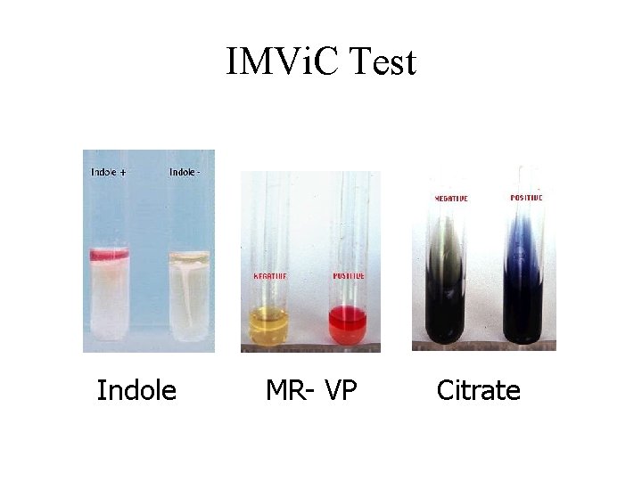 IMVi. C Test Indole MR- VP Citrate 