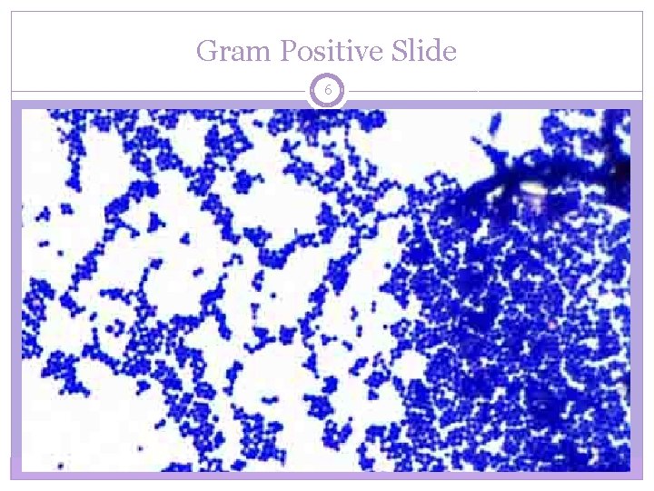 Gram Positive Slide 6 