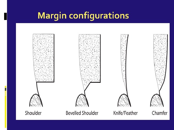 Margin configurations 