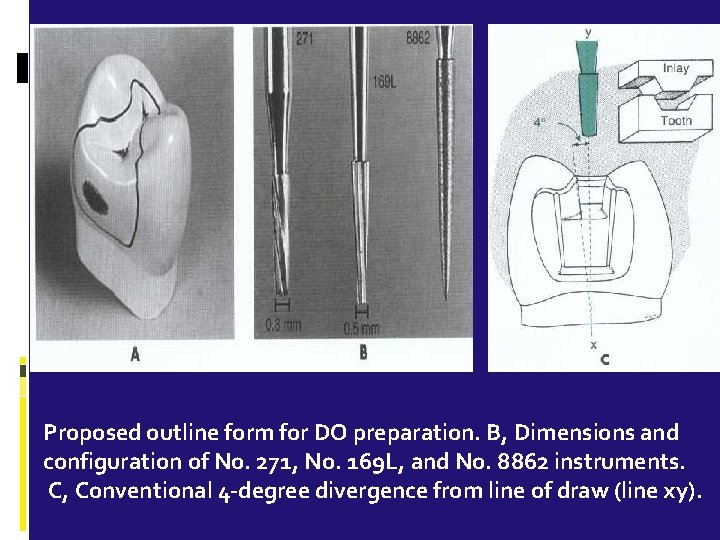 Proposed outline form for DO preparation. B, Dimensions and configuration of No. 271, No.