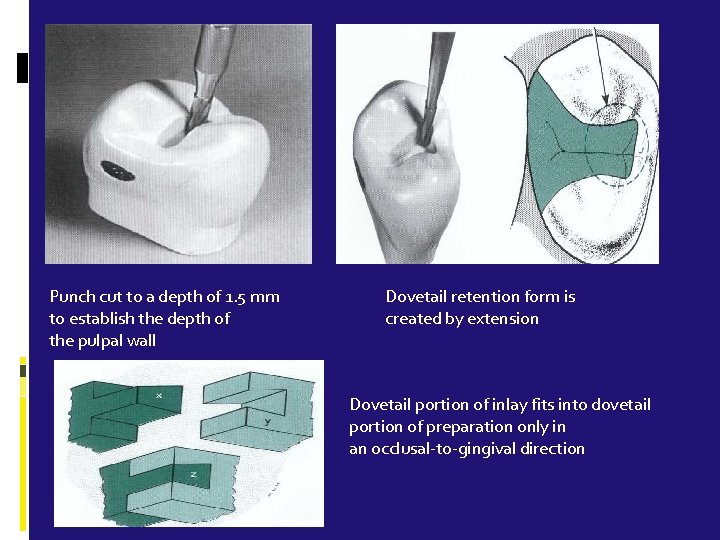 Punch cut to a depth of 1. 5 mm to establish the depth of