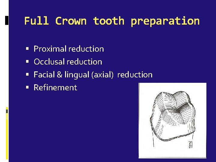 Full Crown tooth preparation Proximal reduction Occlusal reduction Facial & lingual (axial) reduction Refinement