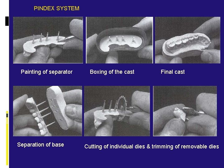 PINDEX SYSTEM Painting of separator Separation of base Boxing of the cast Final cast