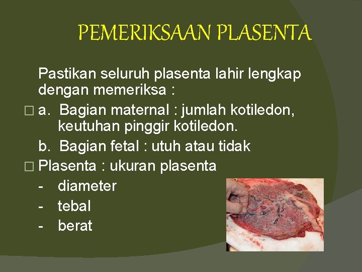 PEMERIKSAAN PLASENTA Pastikan seluruh plasenta lahir lengkap dengan memeriksa : � a. Bagian maternal