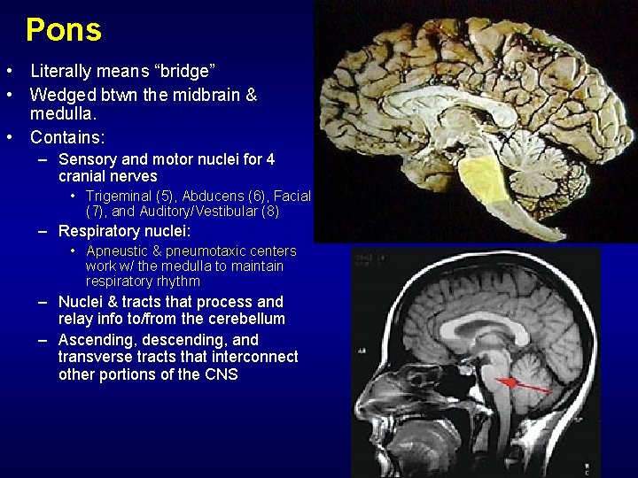 Pons • Literally means “bridge” • Wedged btwn the midbrain & medulla. • Contains: