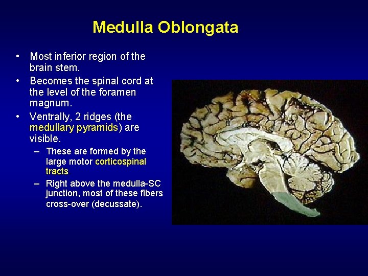 Medulla Oblongata • Most inferior region of the brain stem. • Becomes the spinal
