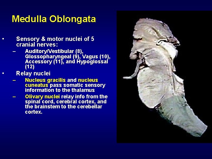 Medulla Oblongata • Sensory & motor nuclei of 5 cranial nerves: – • Auditory/Vestibular