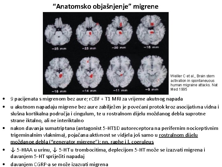 “Anatomsko objašnjenje” migrene Weiller C et al. , Brain stem activation in spontaneuous human
