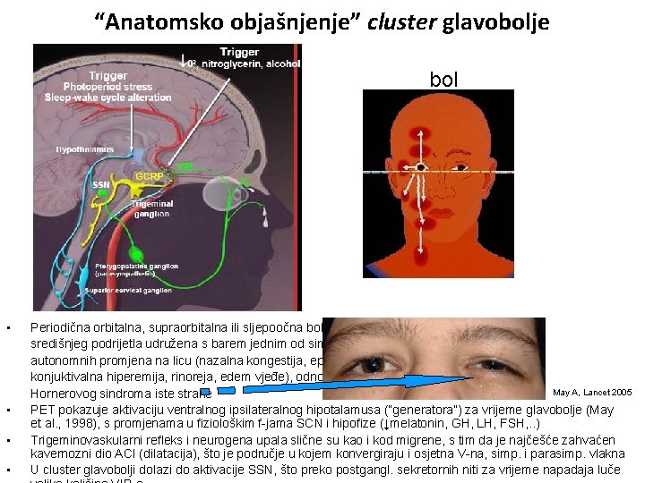“Anatomsko objašnjenje” cluster glavobolje bol • • Periodična orbitalna, supraorbitalna ili sljepoočna bolnost središnjeg