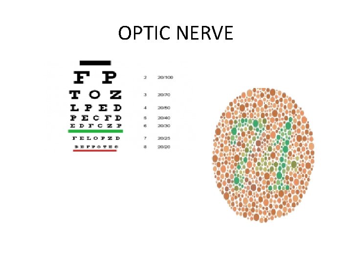 OPTIC NERVE 